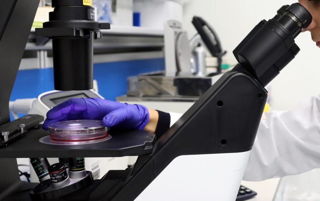 Analisi campione al microscopio. Photo da Ufficio Stampa Ospedale Pediatrico Bambin Gesù