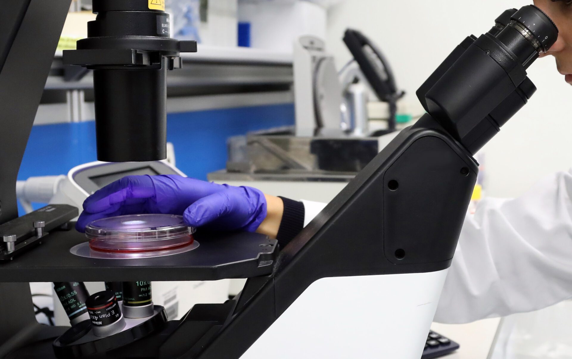 Analisi campione al microscopio. Photo da Ufficio Stampa Ospedale Pediatrico Bambin Gesù